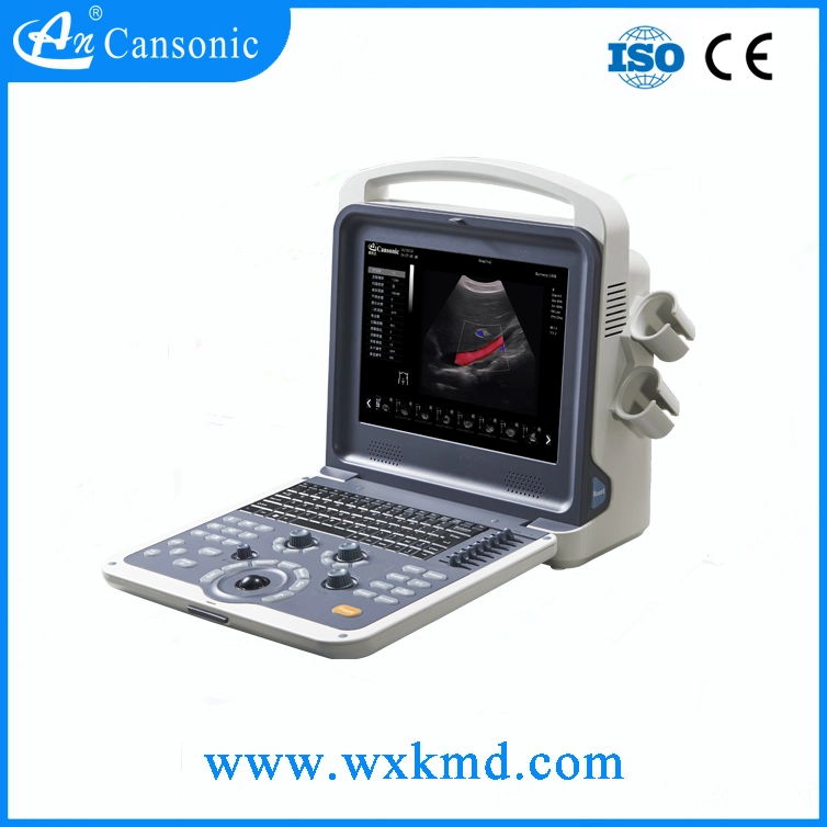 Advanced 4D Portable Full Digital Color Doppler Ultrasound Scanner (K2)