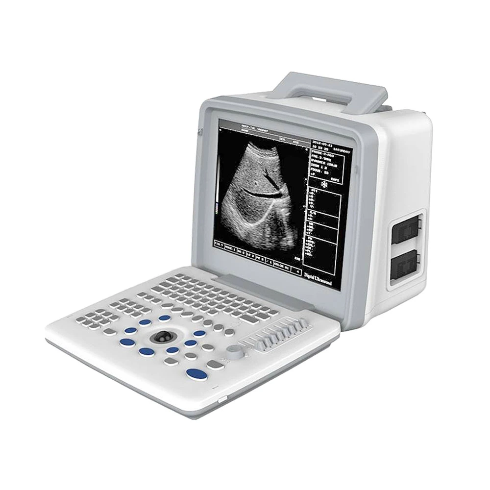 Ltub62V Cheap Diagnostic Equipment Laptop Machine Full Digital Veterinary LED Portable Ultrasound Scanner