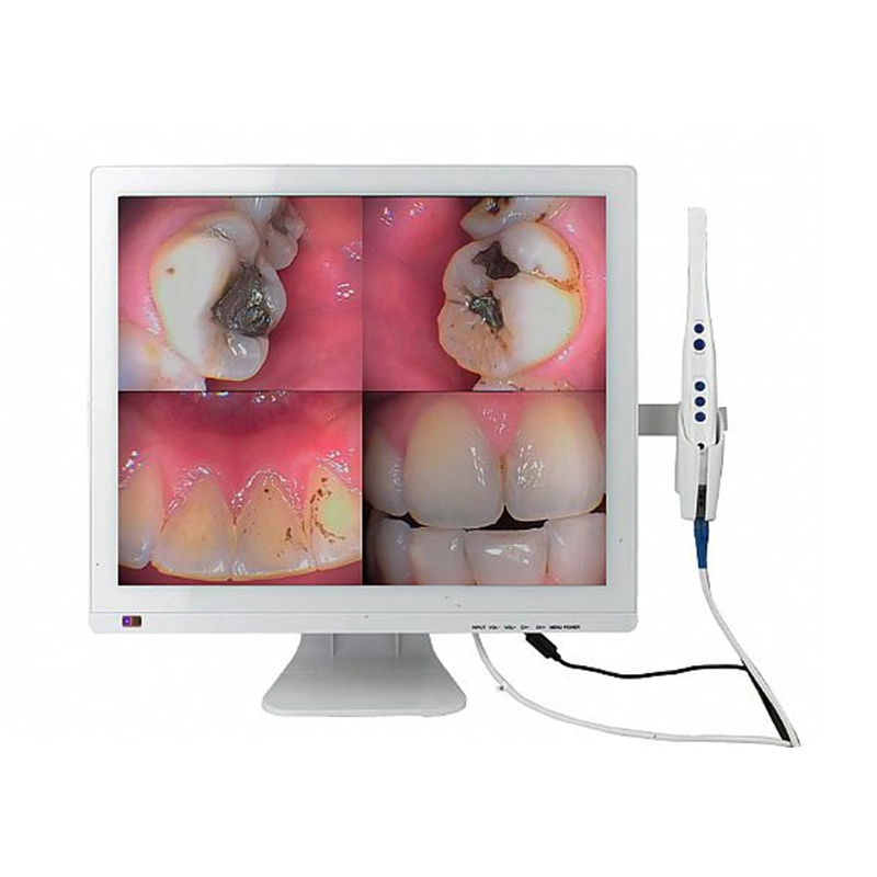 WiFi Dental Intra Oral Camera Image Digital System with Monitor