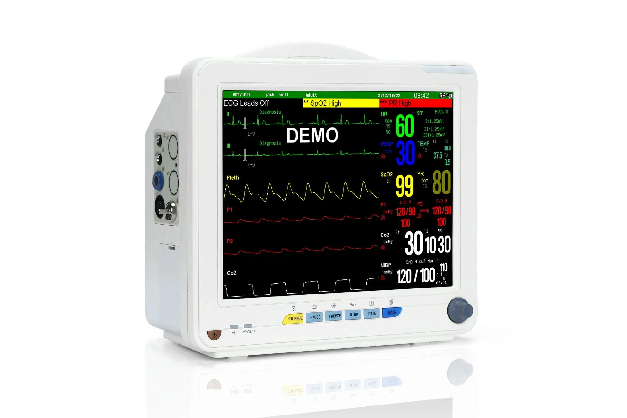 Medical Emergency Multi-Parameter Beside Portable 12 Inch Patient Monitor