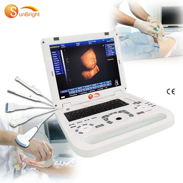 3D ordenador portátil Ultrasound Machine Imágenes de color impresora de ultrasonidos médica