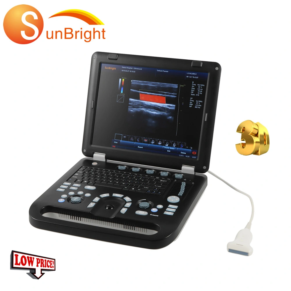 Sun-906b USG Lineat Probe Hospital Colour Doppler 126 Elements Ultrasound