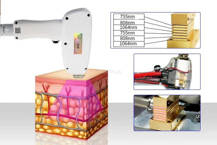 Home Use Al Ma Sop Rano Titanium 12 Bars 755 808 1064nm Diode Laser System for Hair Removal