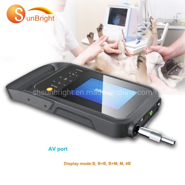 Portable Clinic Handheld Ultrasound Scan Ob/Gyn Ultrasound Hight Quality