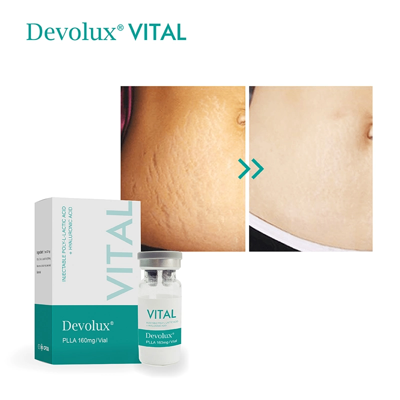 Devolux Vital Reborn PLLA Acido Polilactico Poly L Milchsäure Face Lifting Filler für Wangeneinspritzung