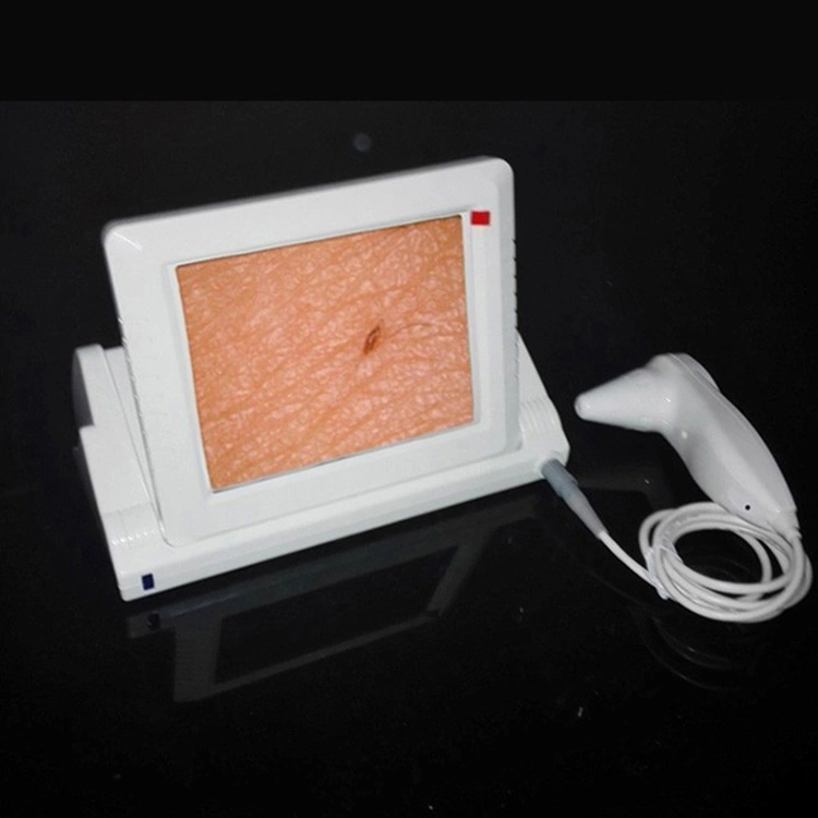 Allfond Skin Analyzer Skin Test Machine mit 8 Zoll Bildschirm