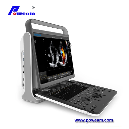 High-End 15' LED-Bildschirm Portable Color Doppler Ultraschall-Maschine System