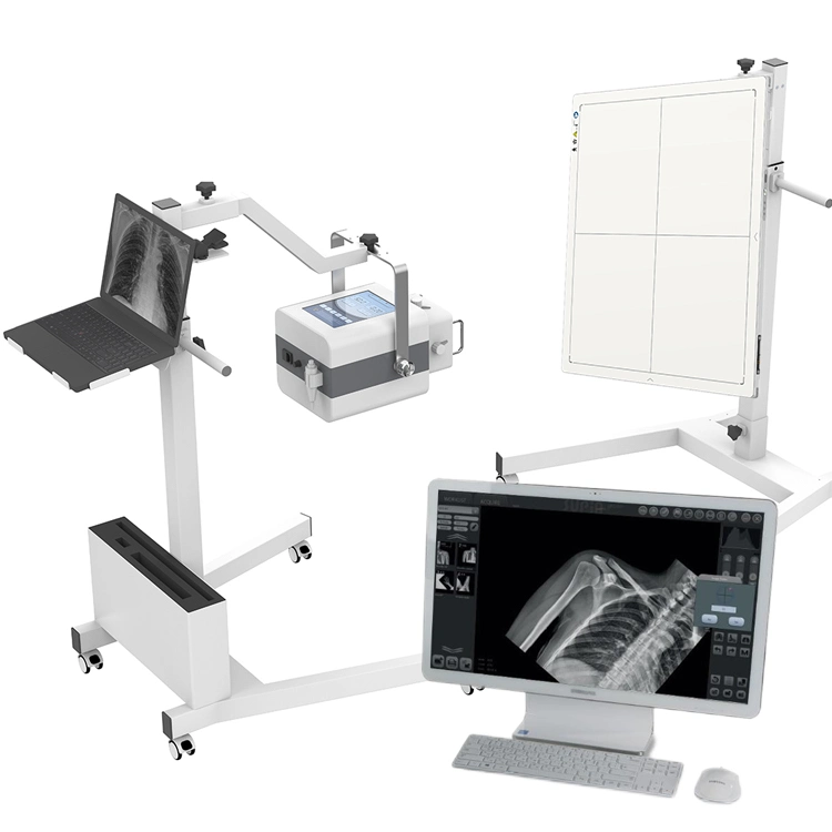 Iray Mars 1417V Dr Detector 17*17 Wireless Csi Flat Panel Detector with Pacs Software Price