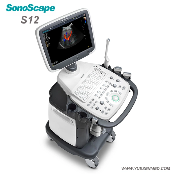 Hospital Medical Trolley 4D Color Doppler Sonoscape S12