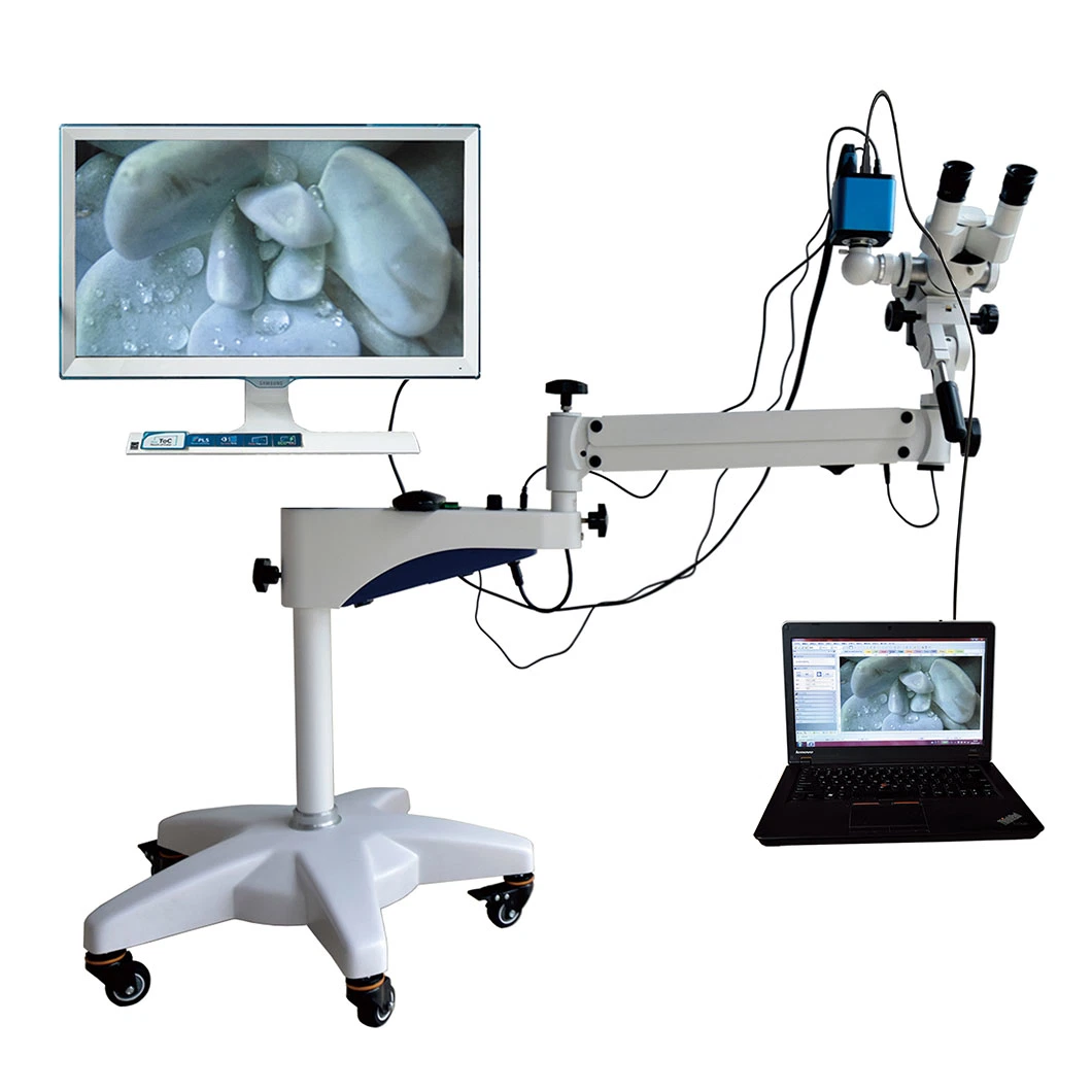 High Resolution Camera Video Vaginal Operation Microscope with 10W LED Lamp