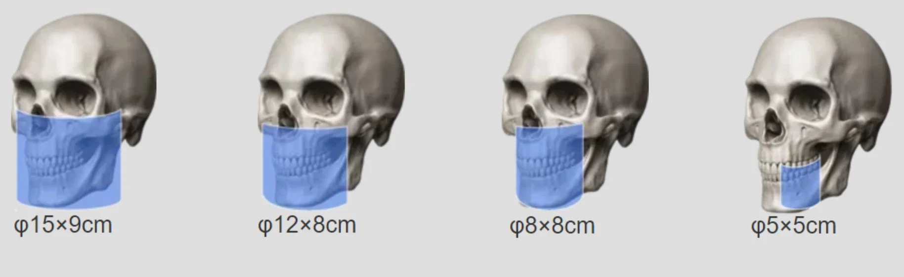 Smart 2D 3D de la Clínica del Hospital Panorámica dental Cbct cefalométrico digital de imágenes de rayos X computarizada equipos para el diagnóstico con certificado CE Oral