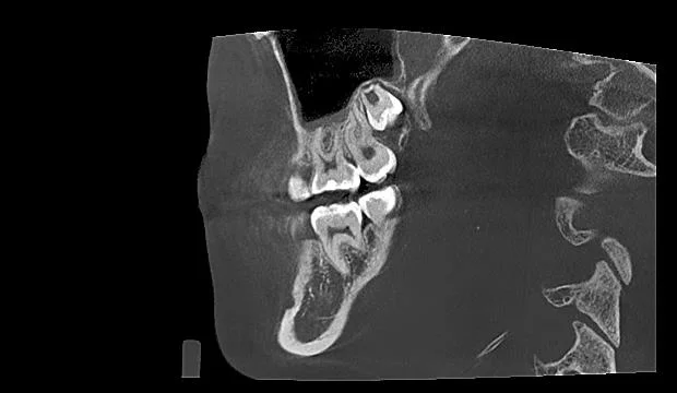 Smart 3D 2D Manufacturer Supplier Digital Panoramic Cephalometric Cbct Dental X-ray Equipment for Oral Diagnosis with CE Certificate