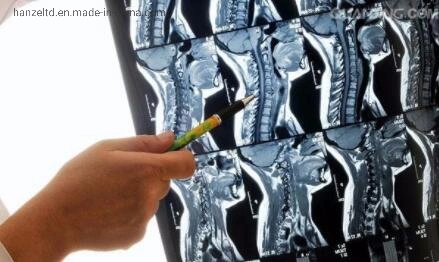 غشاء طبي Blue XRay Dry Clear Inkjet مقاوم للمياه خاص بالطابعة