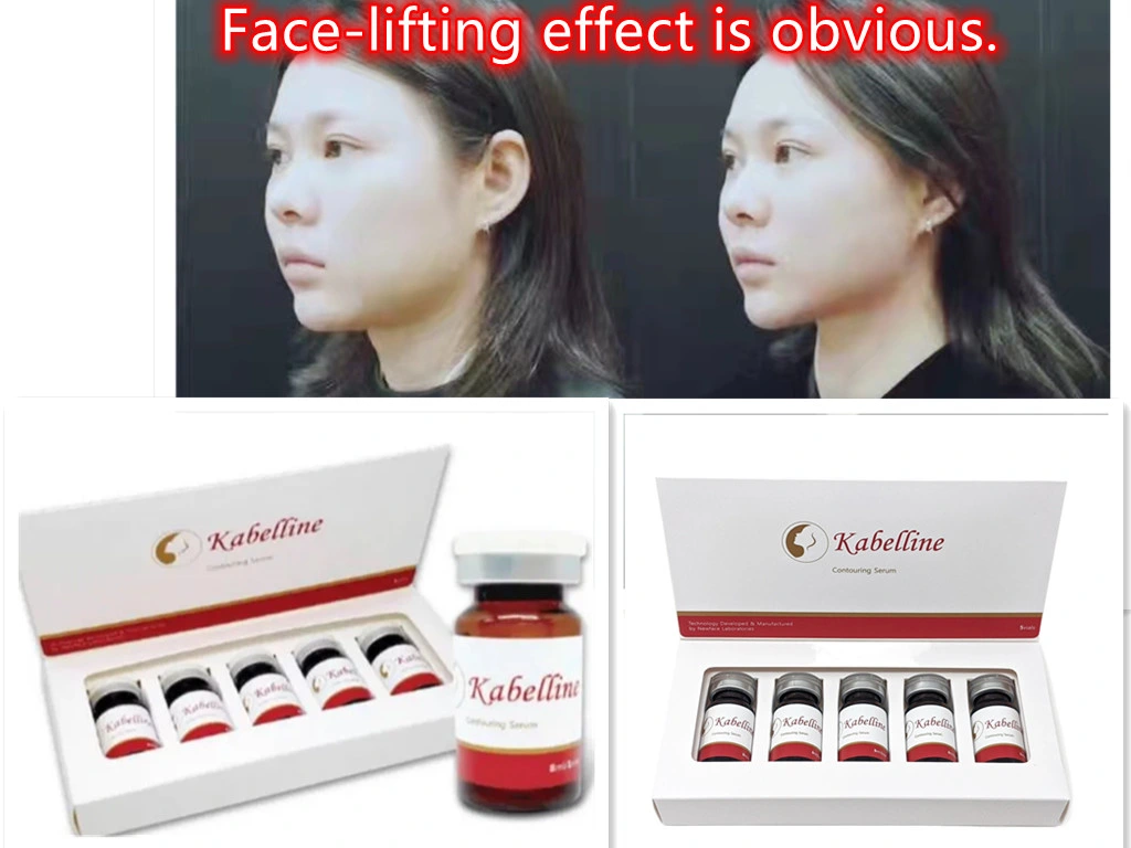 South Korea&prime; S Best Weight Loss Products Wholesale/Supplier Korea Top Quality Kabelline Face Contouring Serum Fat Dissolve Skin Body Care Products Body Slimming