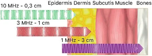 Ultra-sons LDM para remoção do inchaço facial e da beleza da pele hidratante Equipamento