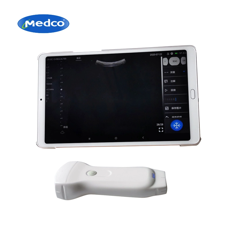 Medical Portable Mini Double Probes Wireless Color Doppler Ultrasound Scanner PU80