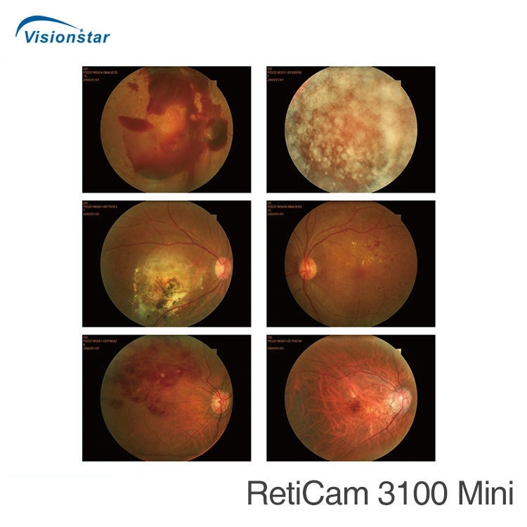 Reticam 3100 (modelo B) fundo de olho da câmara de fundo de angiografia fluorescência &amp; Ffa