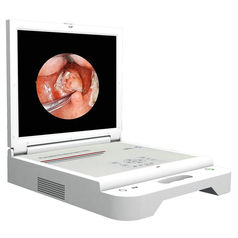 Los instrumentos quirúrgicos Ent Medical 50W LED de endoscopia de fuente de luz fría