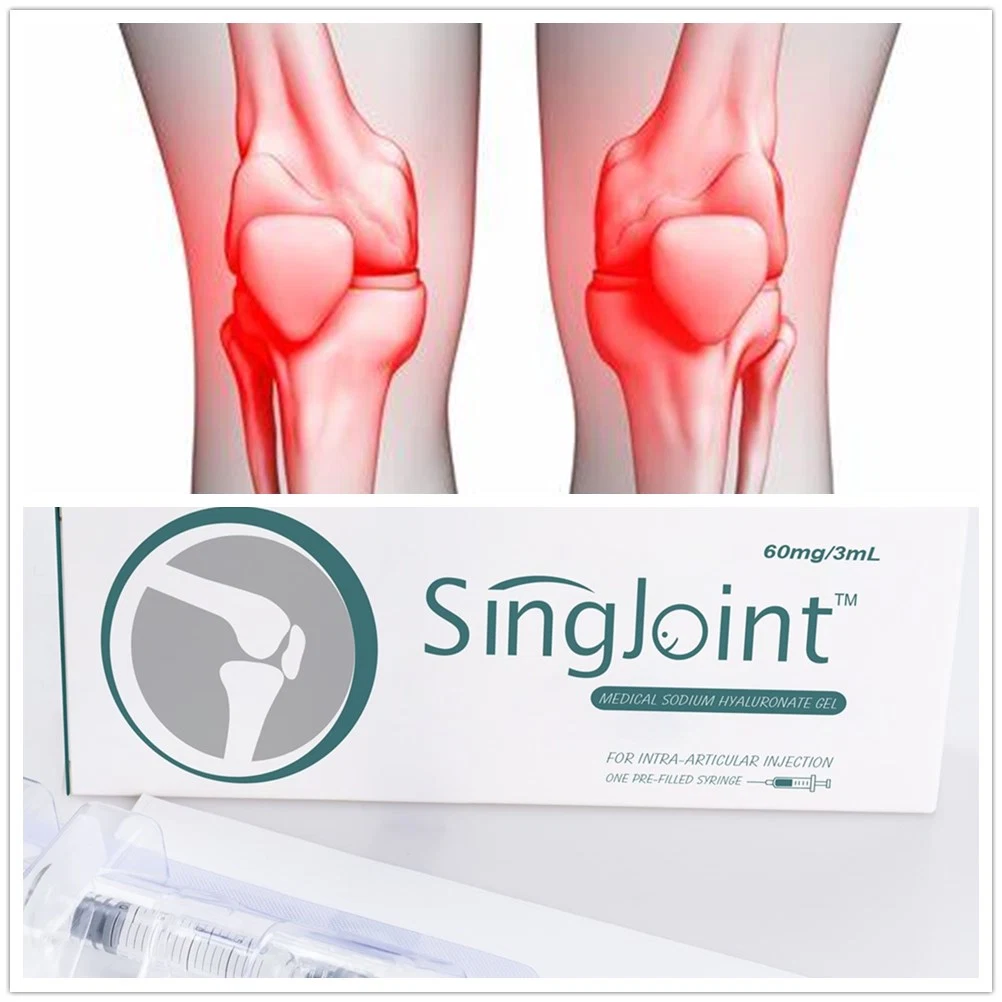 Singjoint Quickclean Ha Medical Sodium Hyaluronate Gel for Orthopedics Surgery Injection