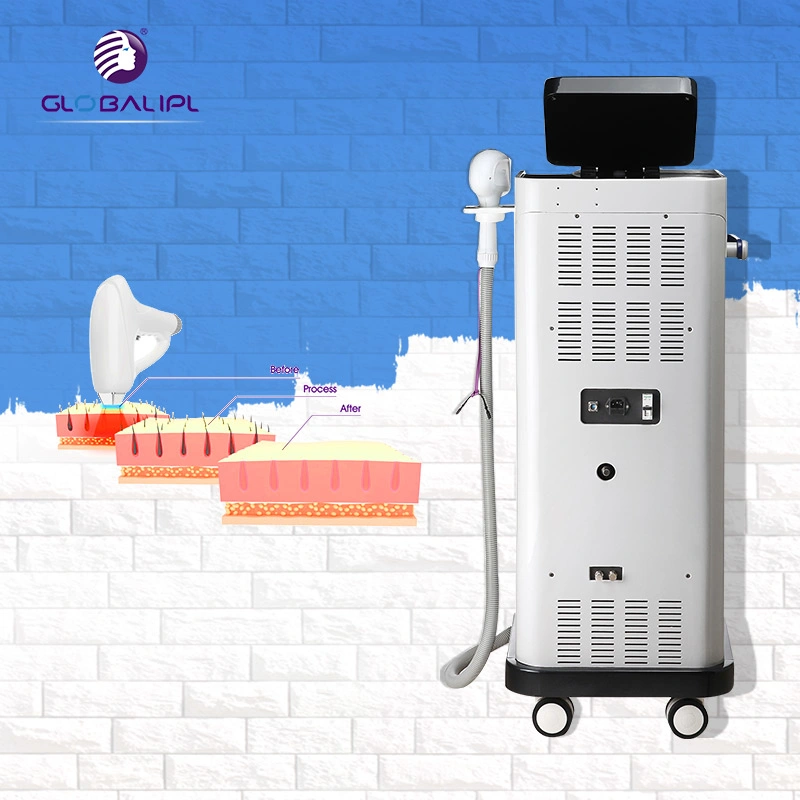 None Channel Triple Wavelengths 808nm 755nm 1064nm Diode Laser Hair Removal Beauty Equipment