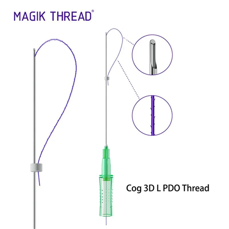 Magik Gewinde Weiche Pdo-Widerhaken-Naht Nicht-Chirurgisch Resorbierbare Pdo-Gewinde Fläche Anheben