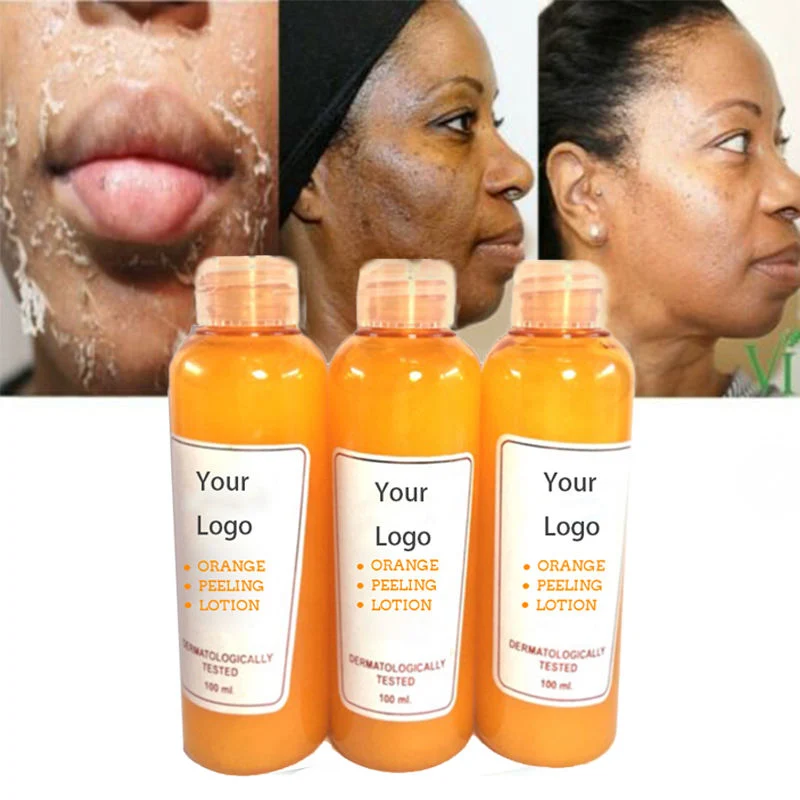 Most Effective Orange Peeling Lotion for Black Skin Whitening