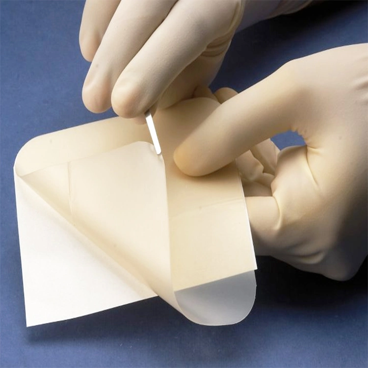 Adhesive Medical Hydrocolloid Dressing with Border for Venous Ulcer Wound Care