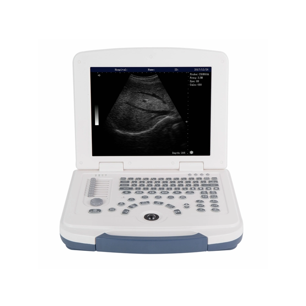 Full Digital LED Ultrasound System Ultrasonido Medico & Medical B&W Portable Ultrasound Machine