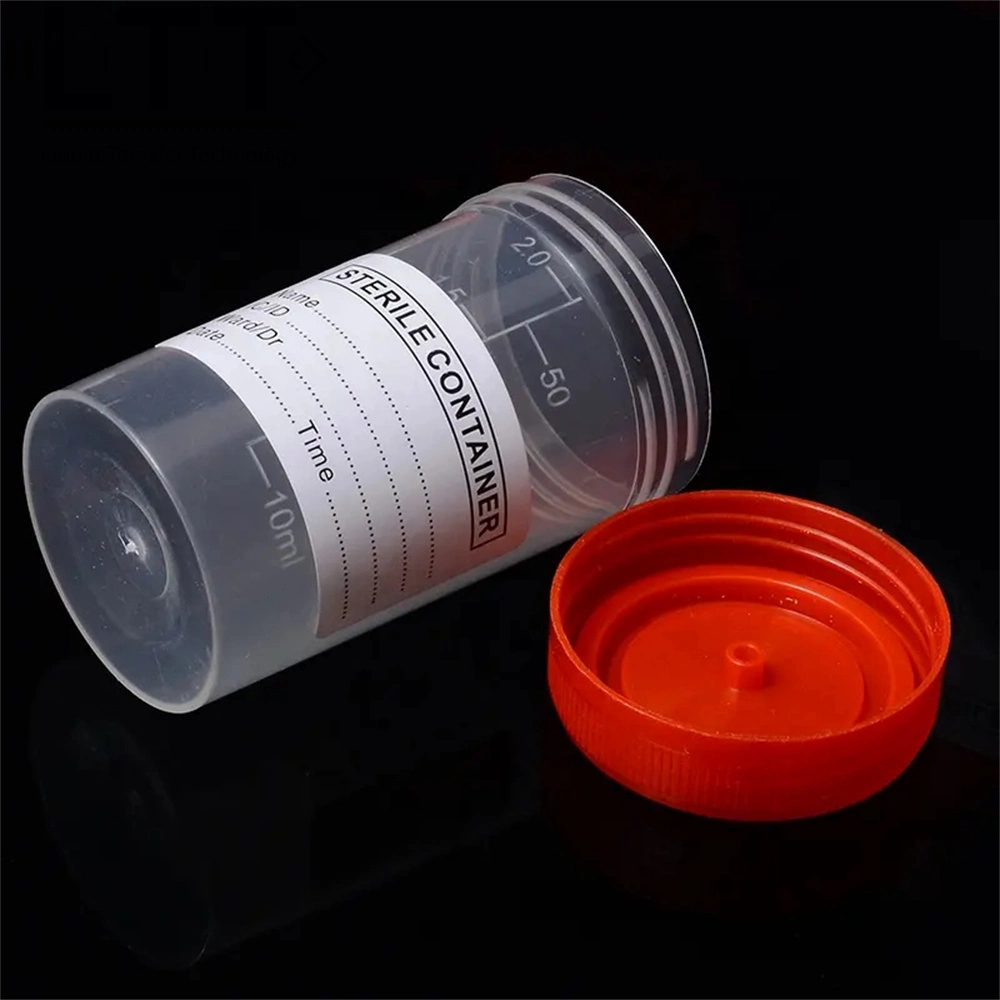 Plastic Urine Sample Cap Medical PP Tubes Hospital Supplies 30ml 50ml 100ml Urine Tube