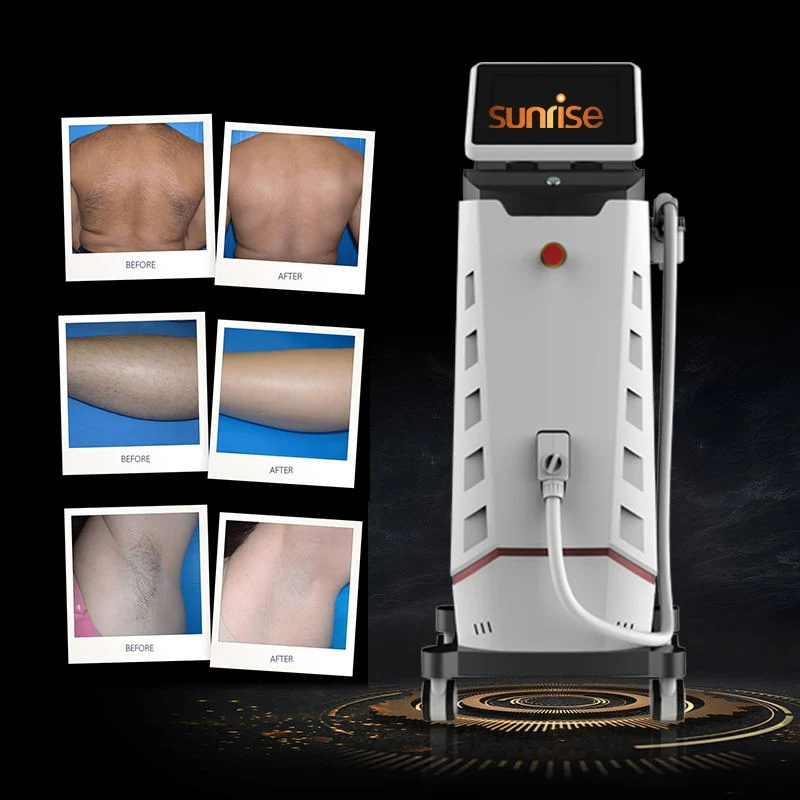 Vertical Professional Hair Removal 808nm Diodo láser Triple longitudes de onda Alexandrita Depilación piel rejuvenecimiento aparato de belleza