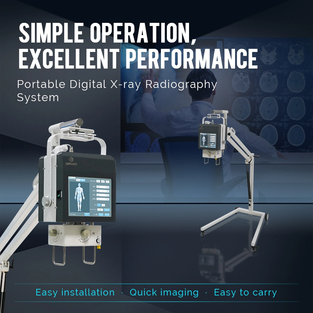 Medizinische Geräte X-ray Medical Digital High Frequency5,3kw Mini Portable X Ray Machine mit DR-System