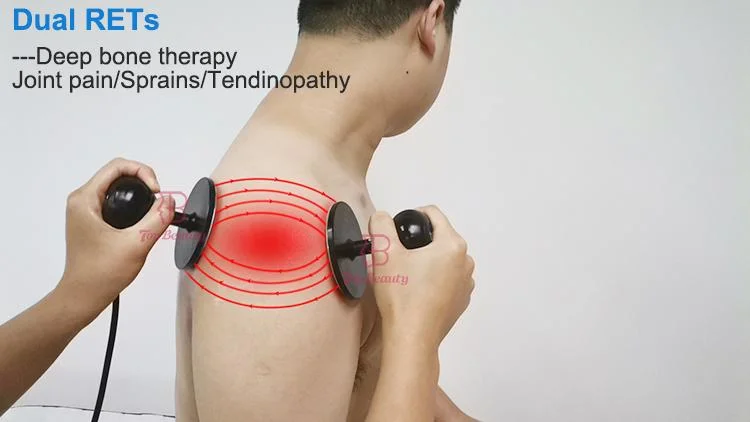 Terapia Tecar Diatermia Capacitiva Y Resistiva Indiba equipamentos de fisioterapia por radiofrequência Reabilitação