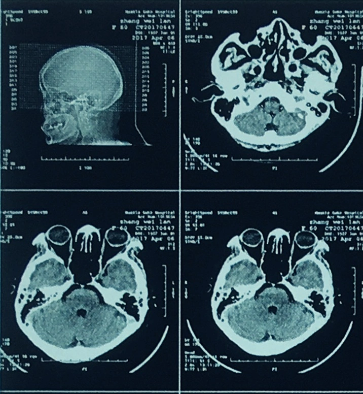 Diagnostische medizinische thermische Röntgenmedien für Agfa Drystar 5301 Drucker