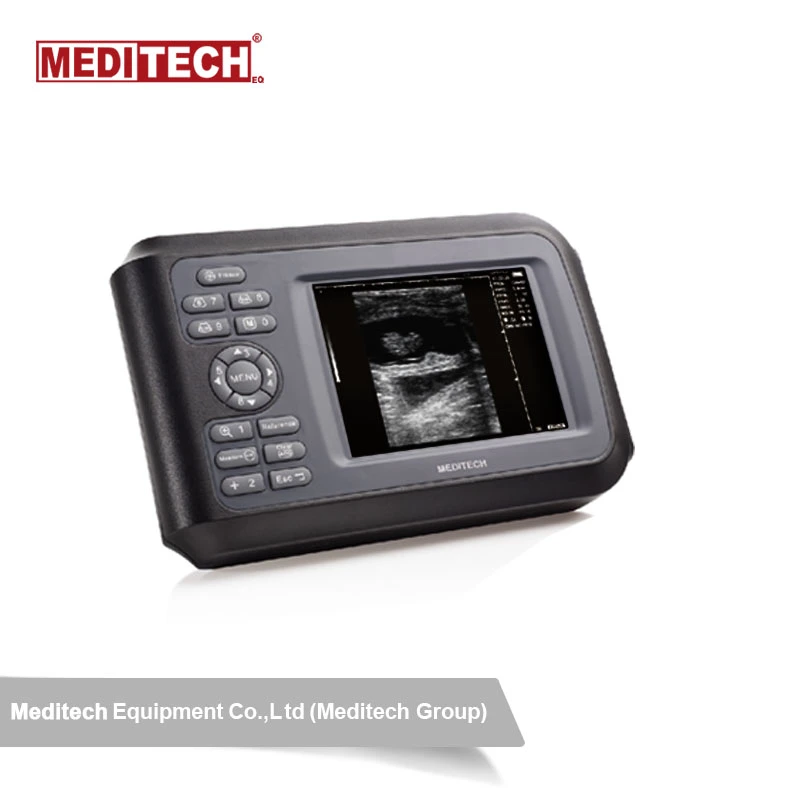 Scanner de ultrassons portátil para diagnóstico médico