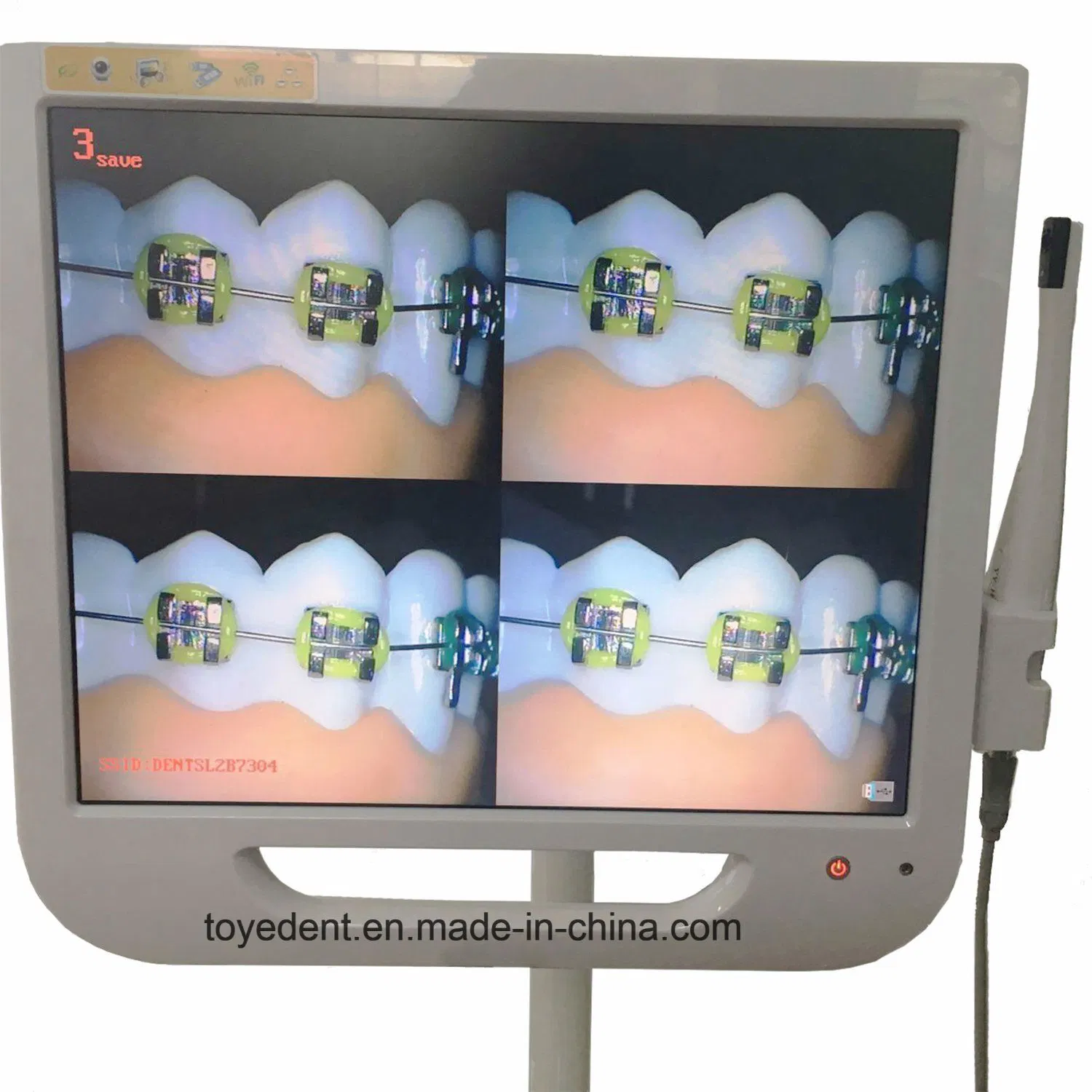 17 Inch Monitor with Built-in Intra Oral Camera