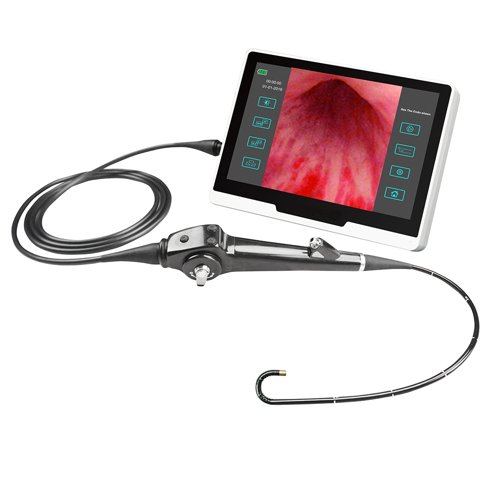 LTEF24B Hospital HD Image Bladder Kidney Examination Flexible Video Cystonephroscope