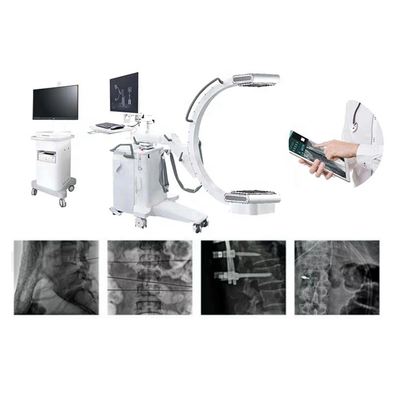 Portable 5kw Digital C Arm X Ray Machine