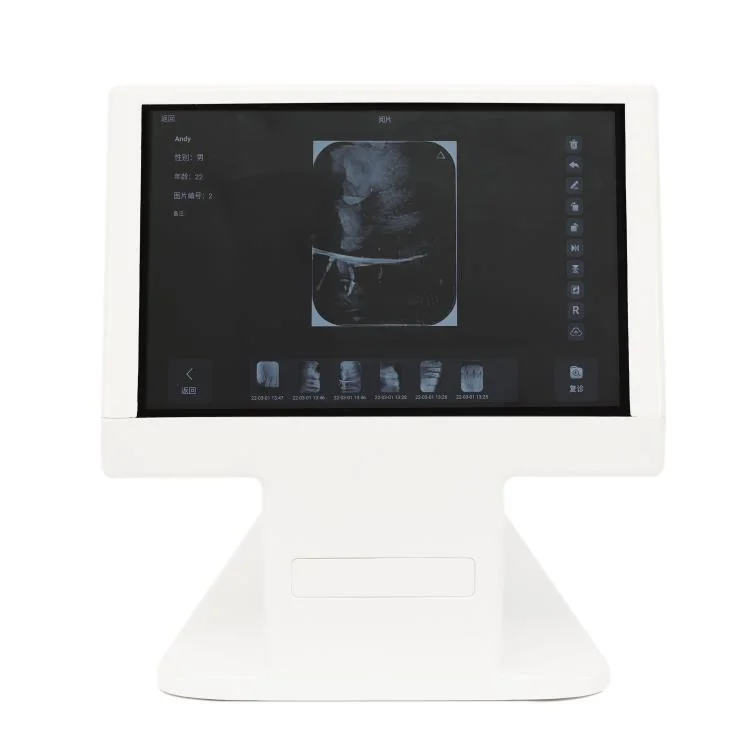 Dynamic Dental Scanning Intraoral Scanning Plate Reader with Large Screen