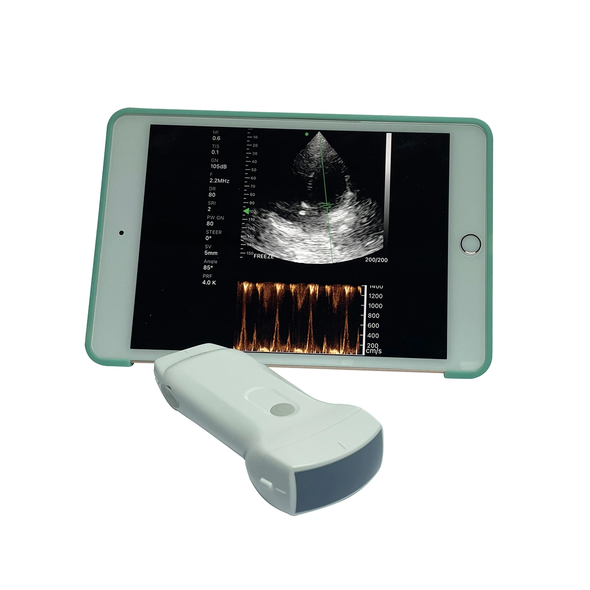 Wireless Android Ultrasound Probe WiFi USB Ultrasound Convex Linear Phased Array Doppler Probe for Pregnancy Price