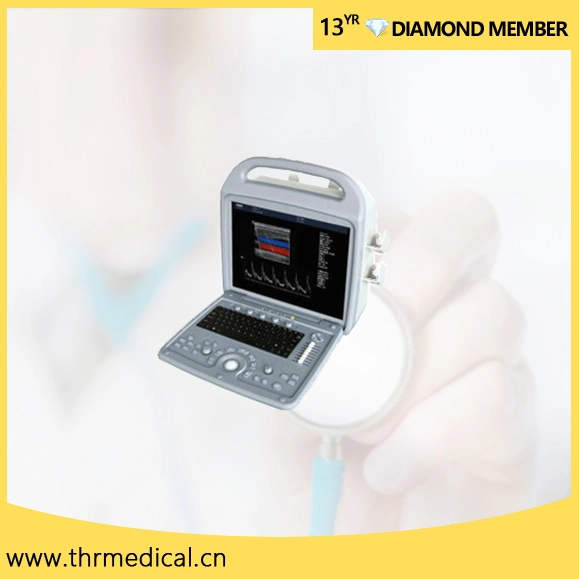 L'échographie portable Vente chaude couleur Scanner (thr-CD580)