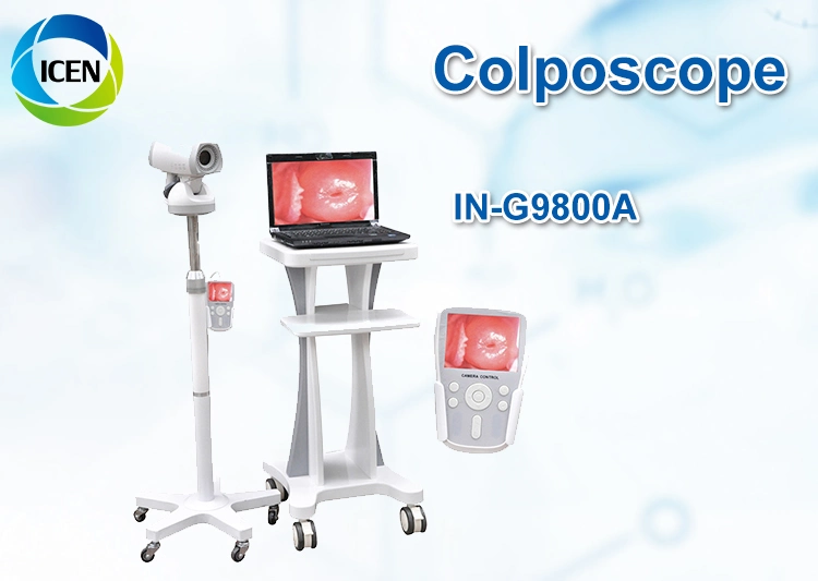 In-G9800A Medical Equipment Colposcope Digital Imaging System Specifications White LED (مواصفات نظام التصوير الرقمي في G9800A) مصدر الضوء لمنظار كولبوسكوب