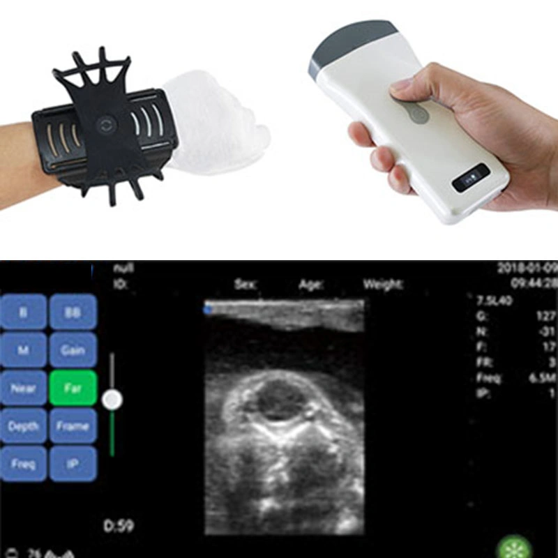 Le poignet Mecanmed Paquet standard de la Chine de l'équipement de diagnostic sonde à ultrasons WiFi