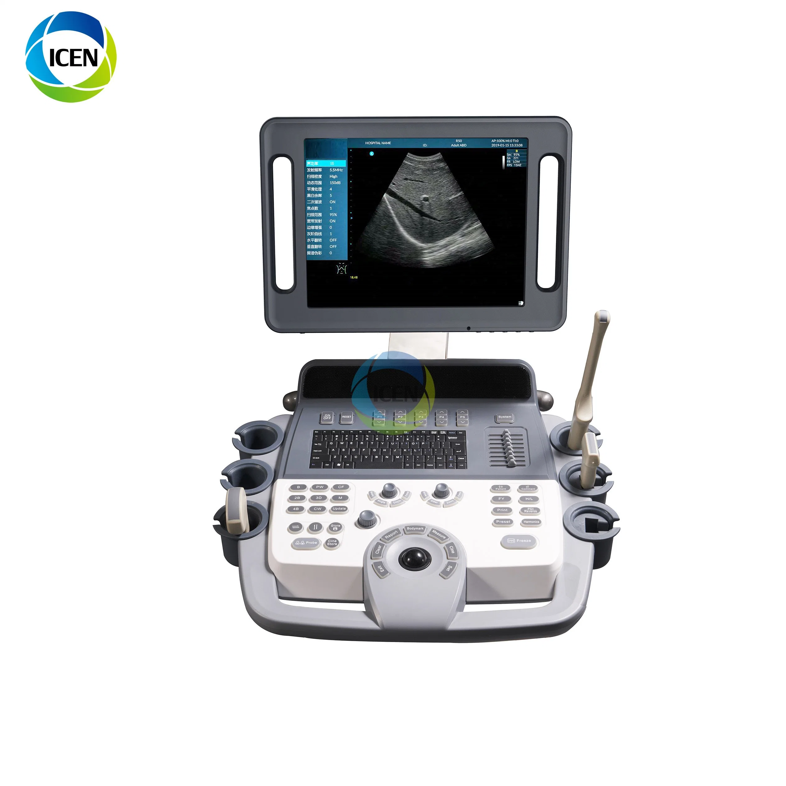 IN-AK12 united ultrasound laptop ultrasound machine color doppler product