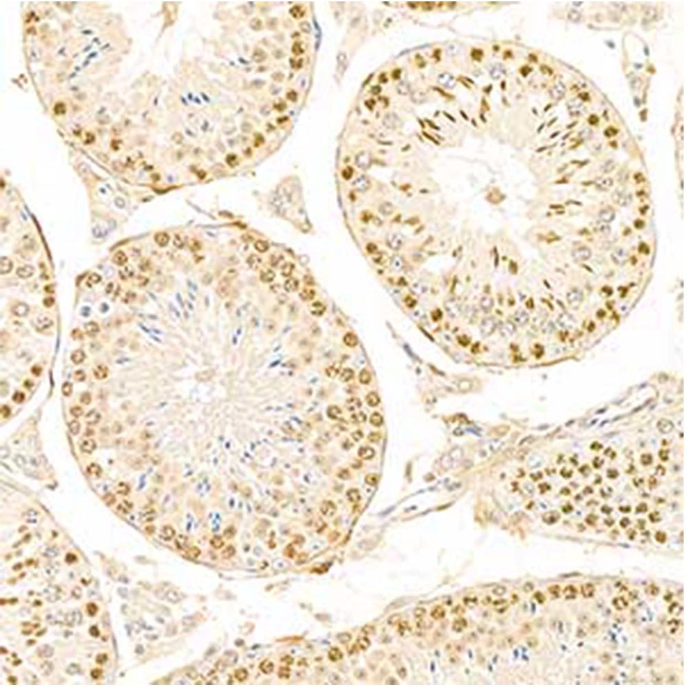 Anti -S100 Alpha 6/Pra Rabbit Primary Polyclonal Antibody