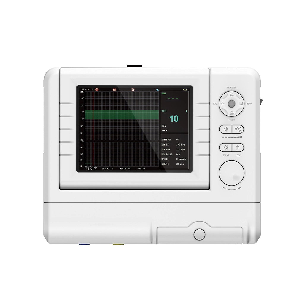 Contec Ce Cms800g Monitor Fetal Ultrasónico de Bebé Ritmo Cardíaco Movimiento del Feto Marca Sensor Toco Máquinas Ctg