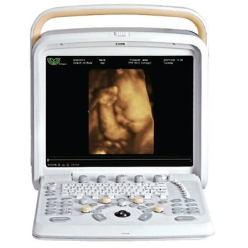 Hot Portable Color Doppler Ultrasound Scanner