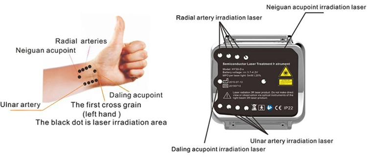 Máquina láser de baja potencia muñeca máquina de tratamiento de la presión arterial
