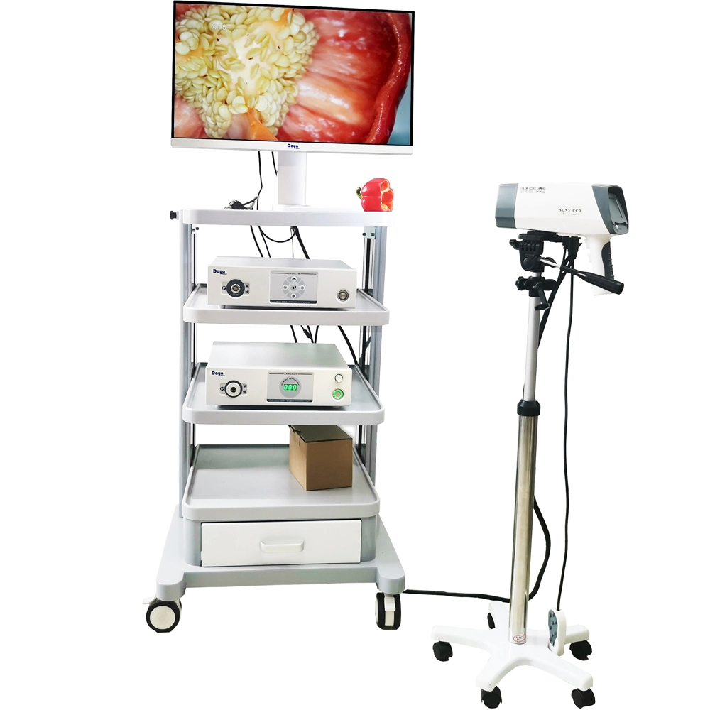 Colposcopia máquina de video digital Colposcopio para Ginecología