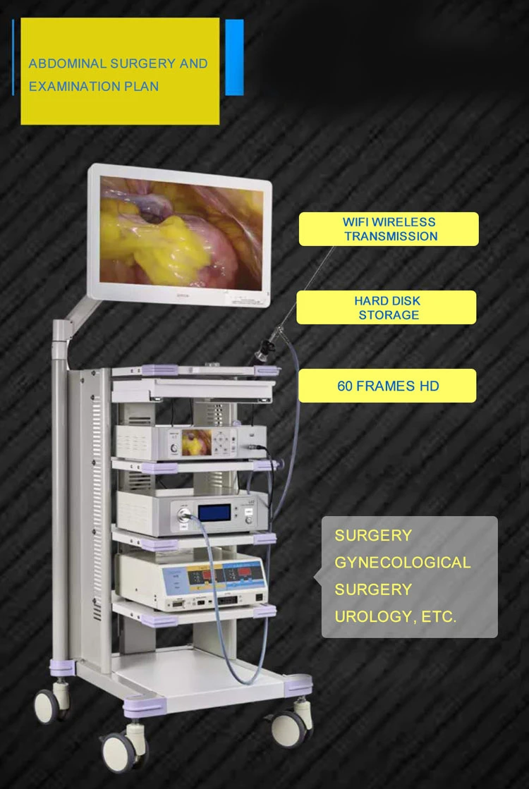 Mon-P046 de l'Hôpital d'approvisionnement médical laparoscopie La chirurgie laparoscopique défini pour la vente