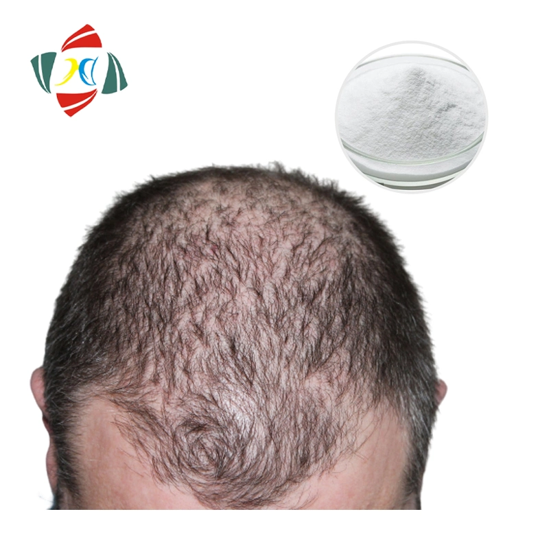 Anti-Hair Loss S-Equol S Equol 99% CAS 531-95-3 Powder S-Equol and Racemic Equol